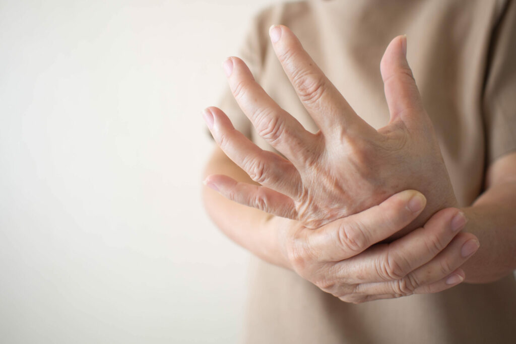 Esclerodermia: enfermedad rara con alto impacto que requiere atención prioritaria
