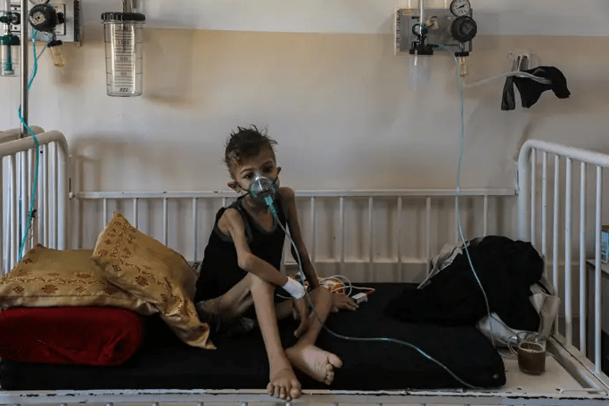 Gaza enferma: Oxfam denuncia bloqueo de ayuda y epidemia en expansión