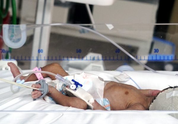 Fiscalía de Ecuador inicia investigación por muerte de 12 recién nacidos en Hospital Universitario de Guayaquil