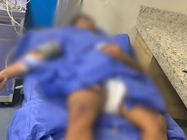 Un sospechoso fue herido tras atacar con arma de fuego a policías, en Manta. (Foto: X de la Policía Nacional).