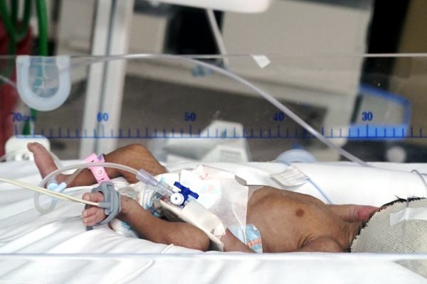 IESS desvincula médicos tras fallecimiento de bebé en hospital de Guayaquil