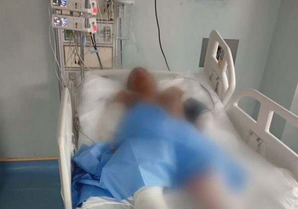 “Leonardo lucha por su vida” el drama tras un accidente mortal en El Carmen