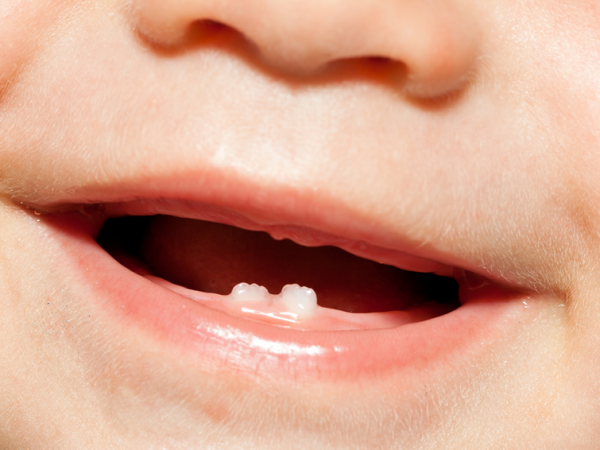 ¿Sabías que los dientes de leche afectan la salud permanente? Aprende cómo cuidarlos