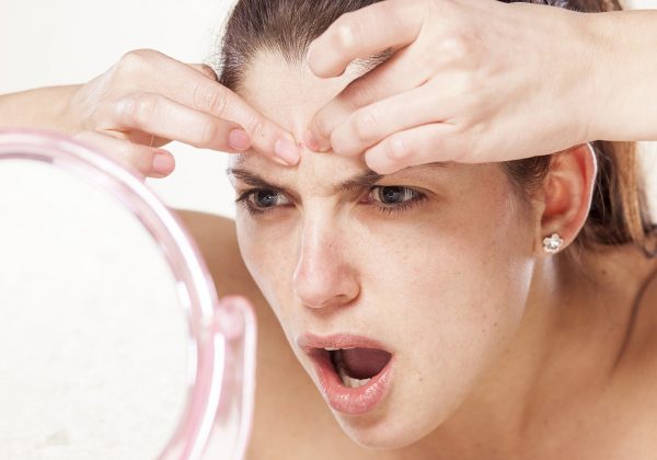 Dermatólogos advierten sobre los riesgos de reventar granos en el rostro