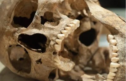 Las zoonosis representan un desafío creciente en la salud global, con eventos como la COVID-19 destacando su relevancia. FOTO: Europa Press.