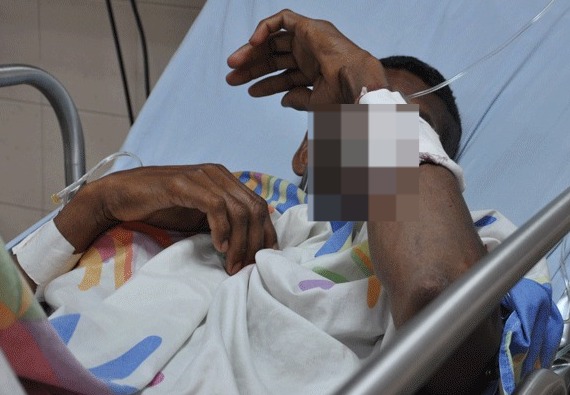 Delincuente resulta herido durante enfrentamiento con la Policía