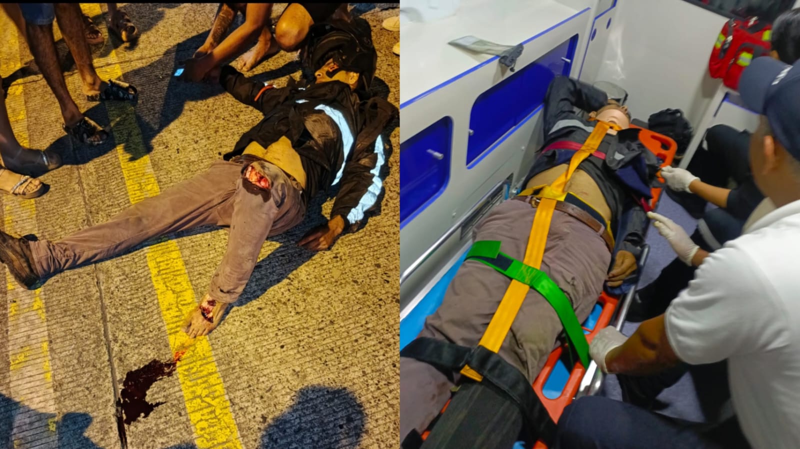 El Carmen. Motociclista murió luego de accidente