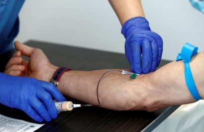 Un nuevo análisis de sangre detecta alzhéimer antes de los primeros síntomas