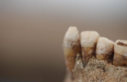La historia de la alimentación prehistórica a través del sarro dental