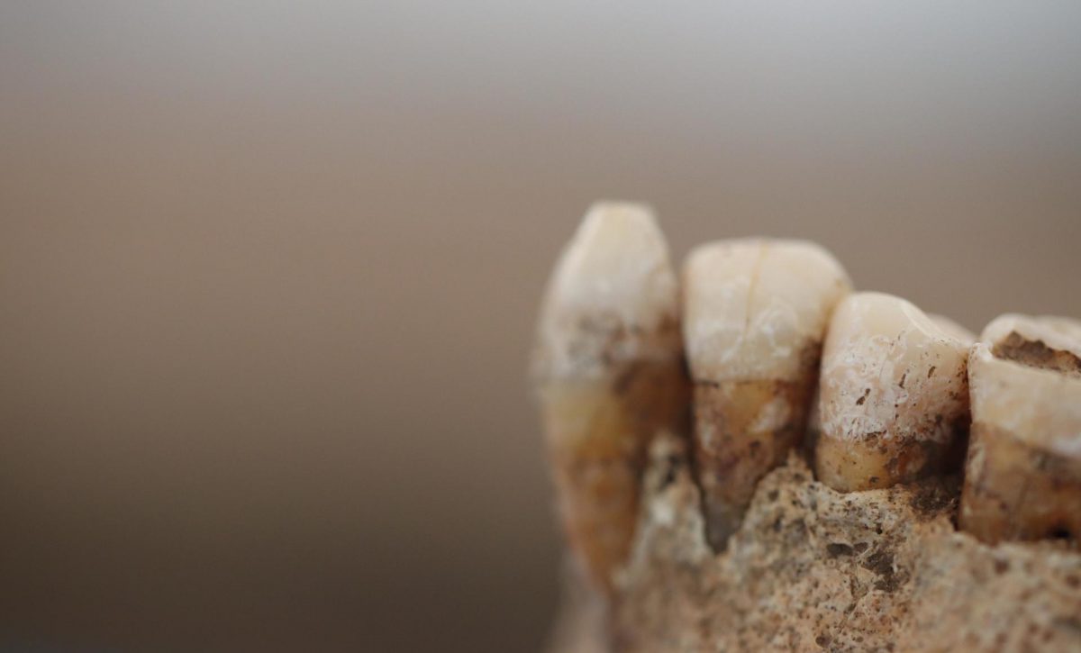 La historia de la alimentación prehistórica a través del sarro dental