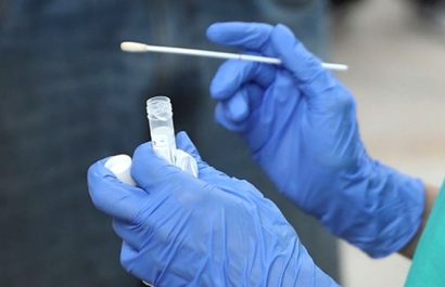 cual-es-el-porcentaje-de-fallo-de-la-pcr