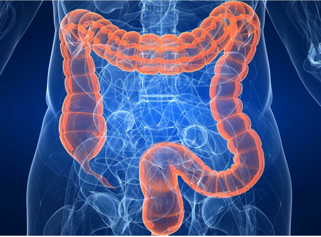 Tratamiento menos invasivo contra el cáncer de recto logra resultados comparables con la cirugía radical