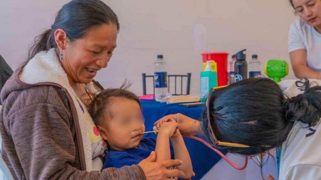 Niños con fisura de labio y paladar serán intervenidos quirúrgicamente de manera gratuita en Quito. (Secretaría Técnica Ecuador Crece sin Desnutrición Infantil)