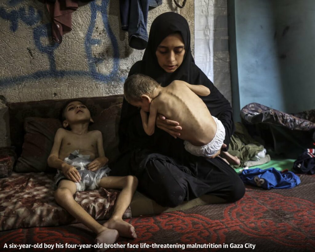 La población de Gaza, de más de dos millones de personas, se enfrenta a una grave escasez de alimentos, muchos niños ya han muerto.
