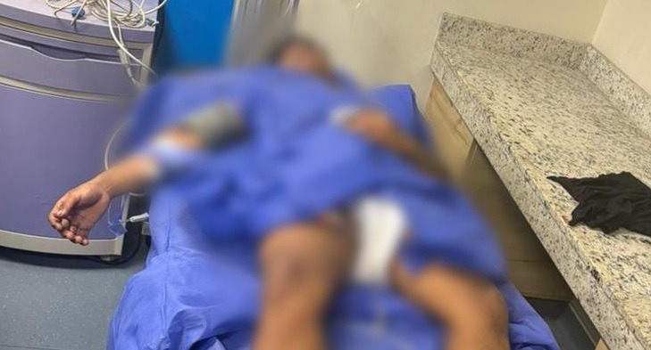 Un sospechoso fue herido tras atacar con arma de fuego a policías, en Manta. (Foto: X de la Policía Nacional).
