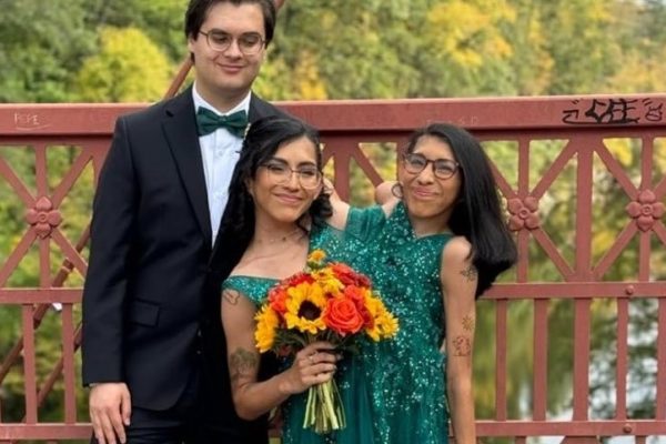 Carmen Andrade, gemela siamesa mexicana de 25 años, ha captado la atención mundial por compartir su vida diaria junto a su hermana