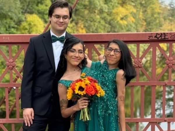 Carmen Andrade, gemela siamesa mexicana de 25 años, ha captado la atención mundial por compartir su vida diaria junto a su hermana