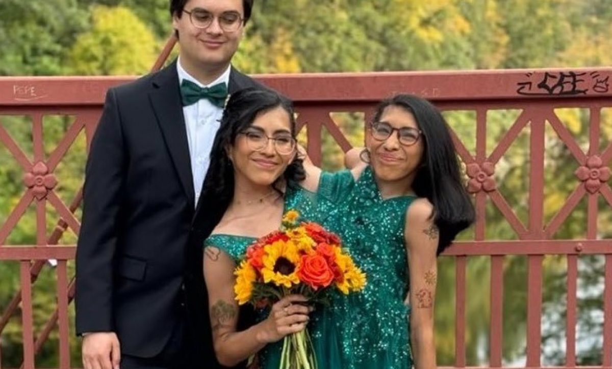 Carmen Andrade, gemela siamesa mexicana de 25 años, ha captado la atención mundial por compartir su vida diaria junto a su hermana