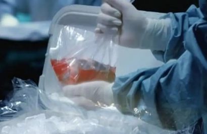 Detienen-a-2-trabajadores-de-hospital-cubano-en-posesion-de-corazones-humanos
