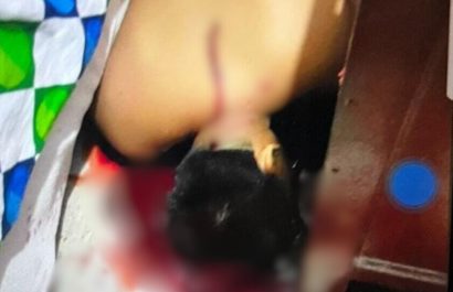El cuerpo de David Delgado quedó a un costado de la cama en la que estaba descansando.