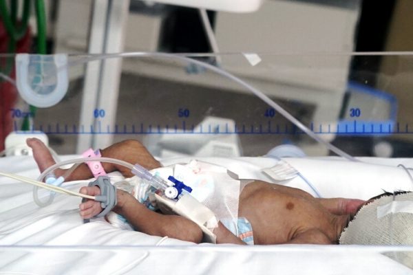 Fiscalía de Ecuador inicia investigación por muerte de 12 recién nacidos en Hospital Universitario de Guayaquil