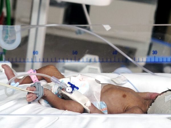 Fiscalía de Ecuador inicia investigación por muerte de 12 recién nacidos en Hospital Universitario de Guayaquil