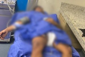 Un sospechoso fue herido tras atacar con arma de fuego a policías, en Manta. (Foto: X de la Policía Nacional).