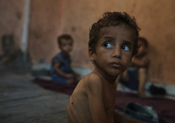 El hambre en Gaza se ensaña con decenas de miles de niños: la malnutrición se triplica en menores de 5 años.