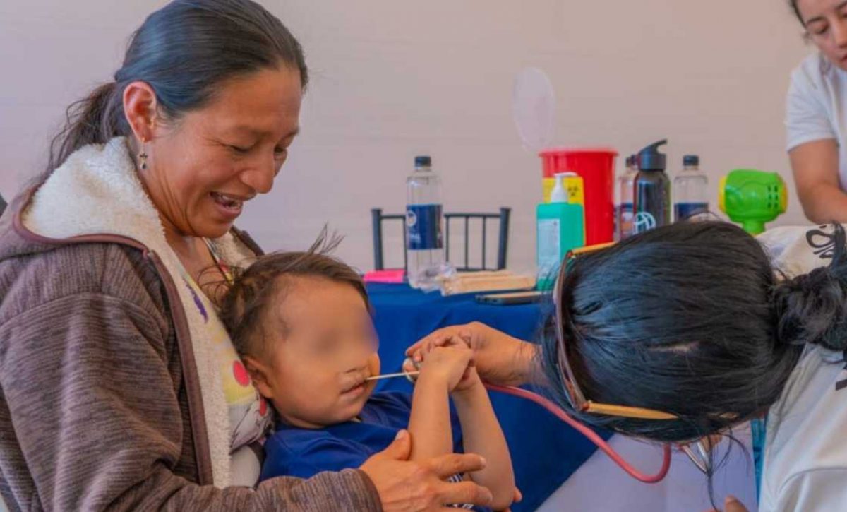 Niños con fisura de labio y paladar serán intervenidos quirúrgicamente de manera gratuita en Quito. (Secretaría Técnica Ecuador Crece sin Desnutrición Infantil)