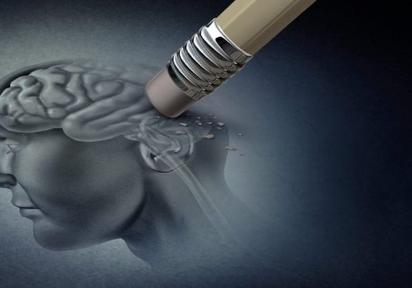 Un fármaco para frenar el Alzheimer es bien tolerado fuera de los ensayos clínicos
