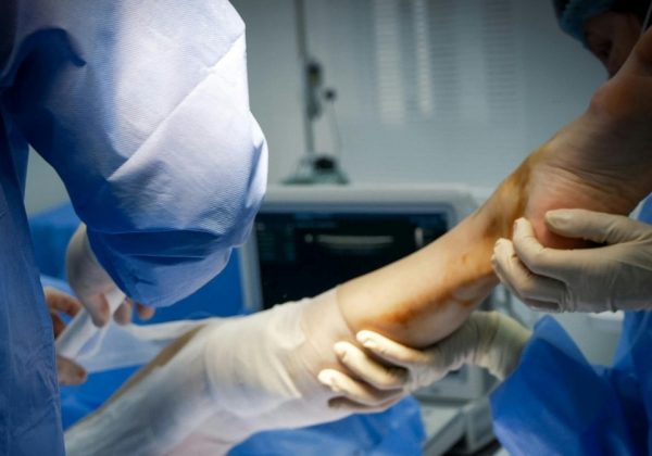 Una mujer fue a ligarse las trompas y terminó con una pierna amputada y con trasplante de corazón, ¿qué le pasó? (Pexels)