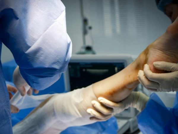 Una mujer fue a ligarse las trompas y terminó con una pierna amputada y con trasplante de corazón, ¿qué le pasó? (Pexels)