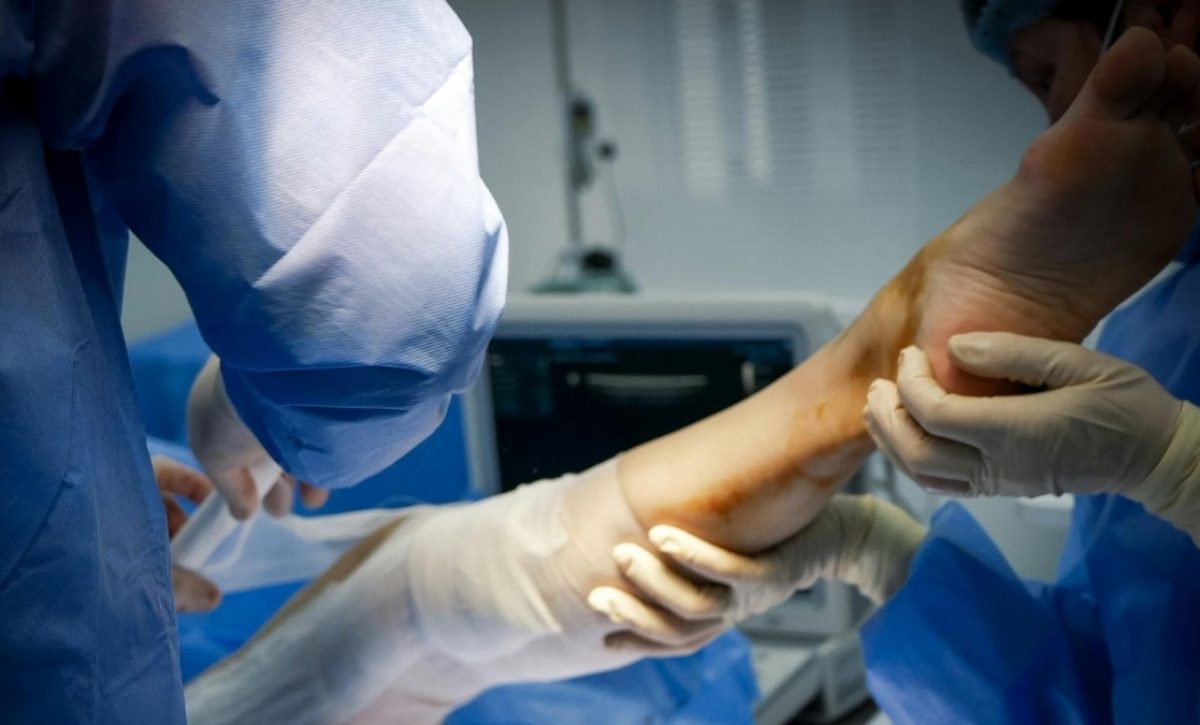 Una mujer fue a ligarse las trompas y terminó con una pierna amputada y con trasplante de corazón, ¿qué le pasó? (Pexels)
