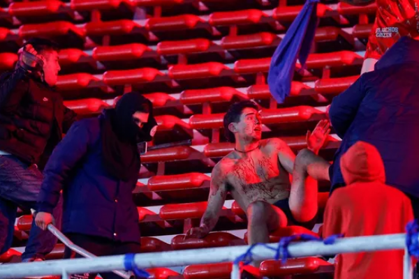 Los violentos enfrentamientos entre las barras del Independiente de Avellaneda y de la Universidad de Chile, ocurridos este miércoles, dejaron un saldo de decenas de heridos y detenidos.