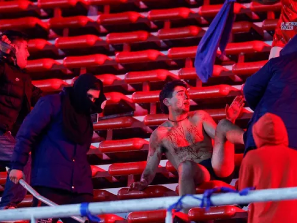 Los violentos enfrentamientos entre las barras del Independiente de Avellaneda y de la Universidad de Chile, ocurridos este miércoles, dejaron un saldo de decenas de heridos y detenidos.