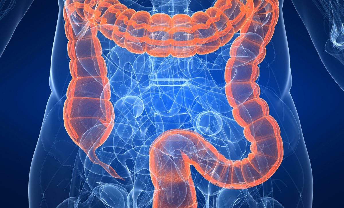 Tratamiento menos invasivo contra el cáncer de recto logra resultados comparables con la cirugía radical