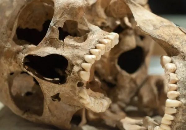 Las zoonosis representan un desafío creciente en la salud global, con eventos como la COVID-19 destacando su relevancia. FOTO: Europa Press.