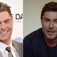 El “nuevo rostro” de Zac Efron desató burlas y críticas en redes sociales