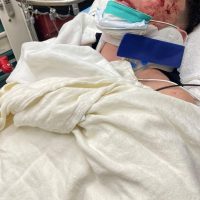 El cantante Guaynaa sufre un fuerte accidente automovilístico en Los Ángeles