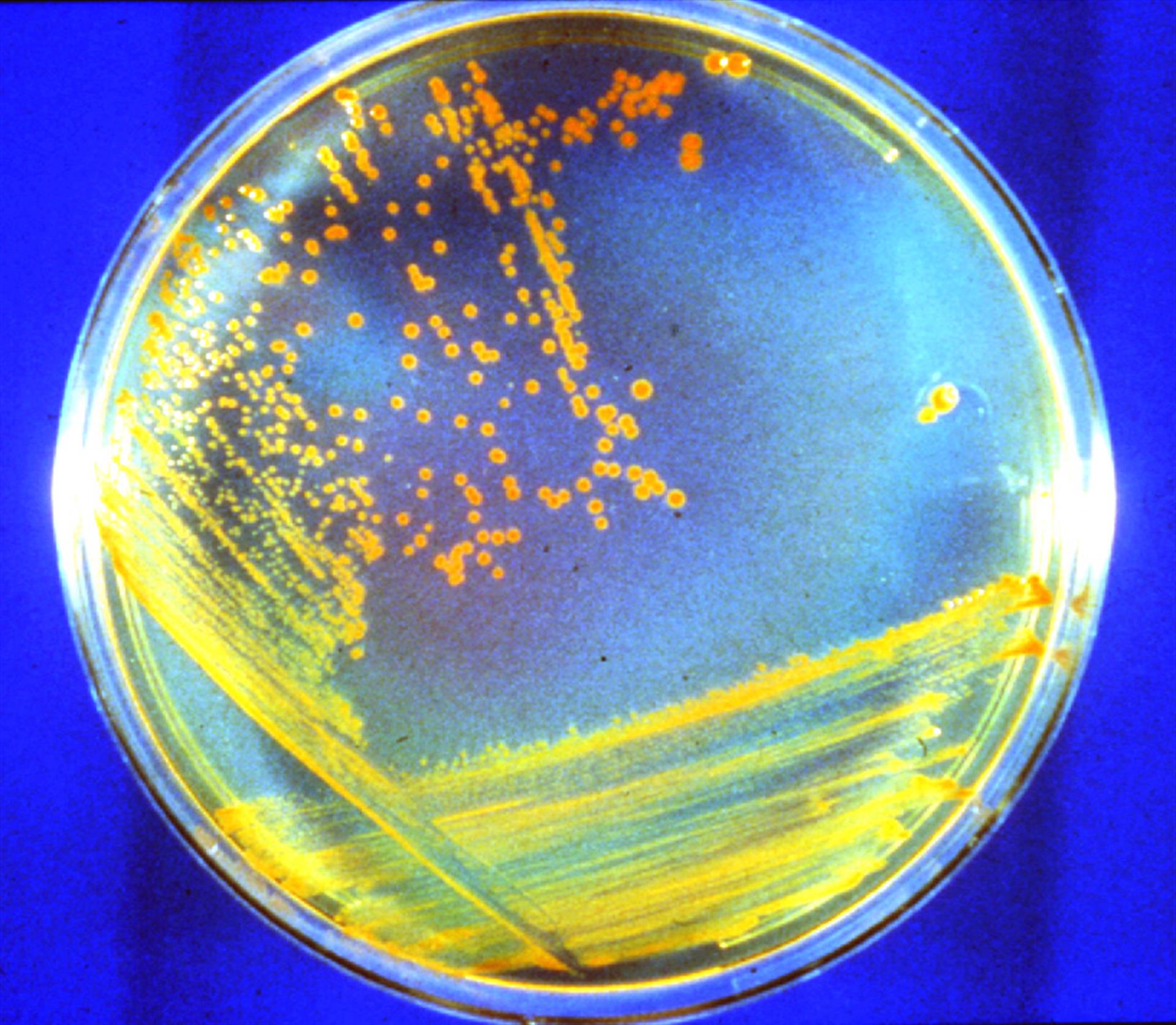 Antiguas bacterias de Marte