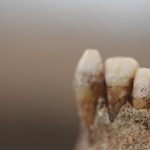 La historia de la alimentación prehistórica a través del sarro dental