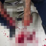 Presunto "vacunador" perdió sus manos al explotar un taco de dinamita en Daule