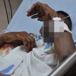 Delincuente resulta herido durante enfrentamiento con la Policía