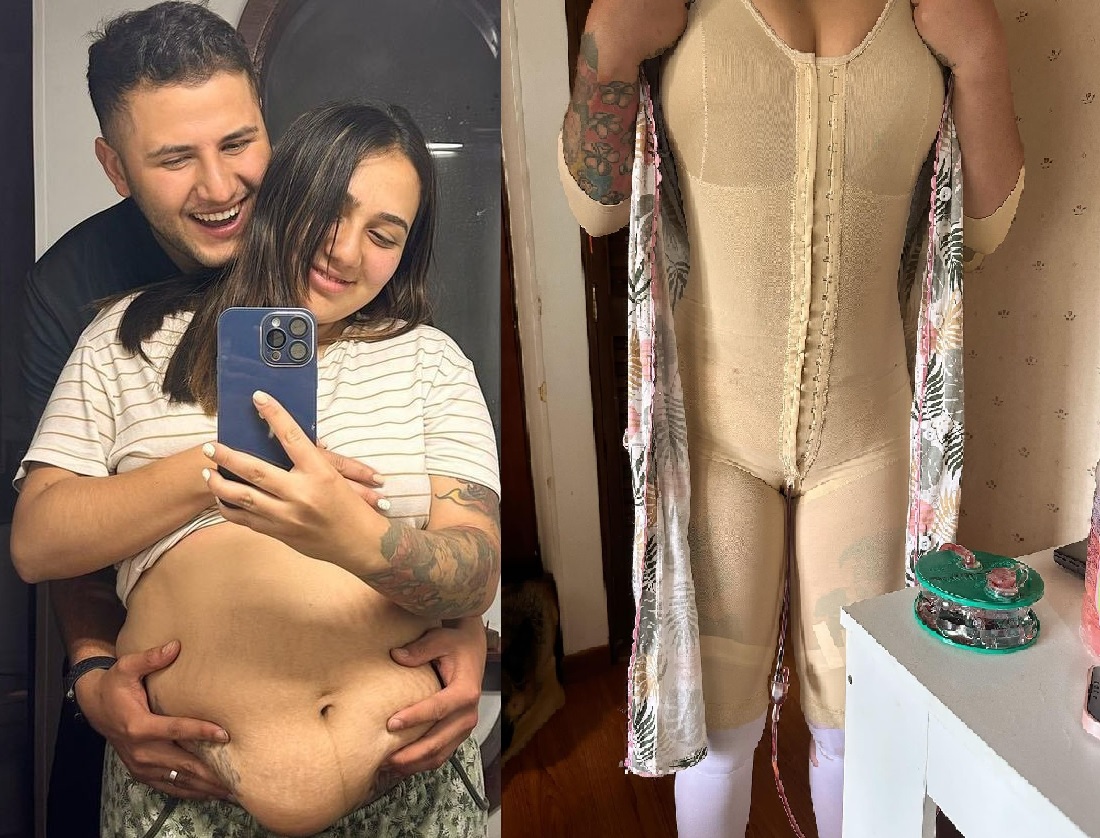 A loving husband worked seven months to pay his beloved’s ‘lipo’