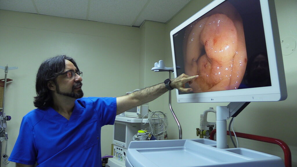 Cáncer de Colon disminuyó en un 25% en Manabí
