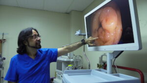 Cáncer de Colon disminuyó en un 25% en Manabí