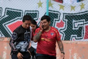 Edison Pilataxi, perdió un ojo durante el partido liga vs cuenca