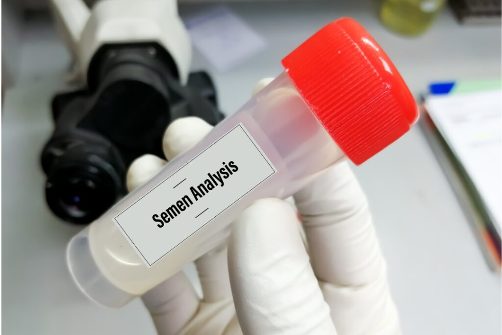 Países Bajos detecta 85 donantes masivos de esperma que superaron límites legales desde 2004