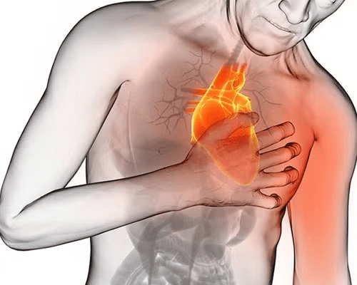 Tu cuerpo podría estar avisando un infarto: aprende a reconocer las señales