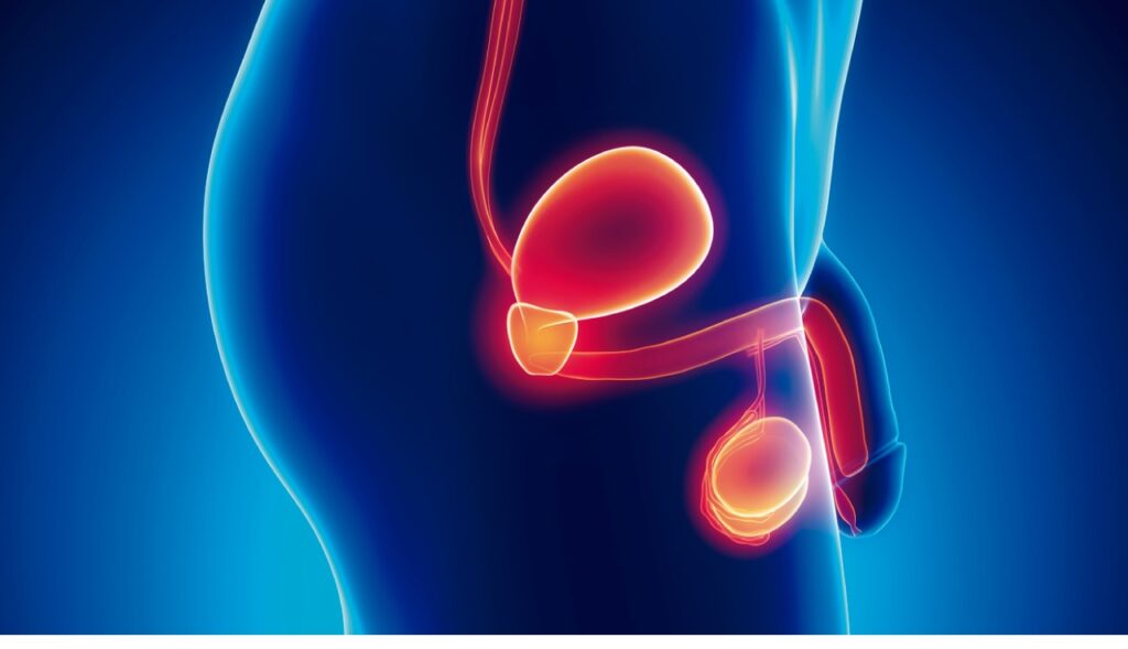 75% de los pacientes de cáncer de próstata logra curarse gracias a un diagnóstico precoz